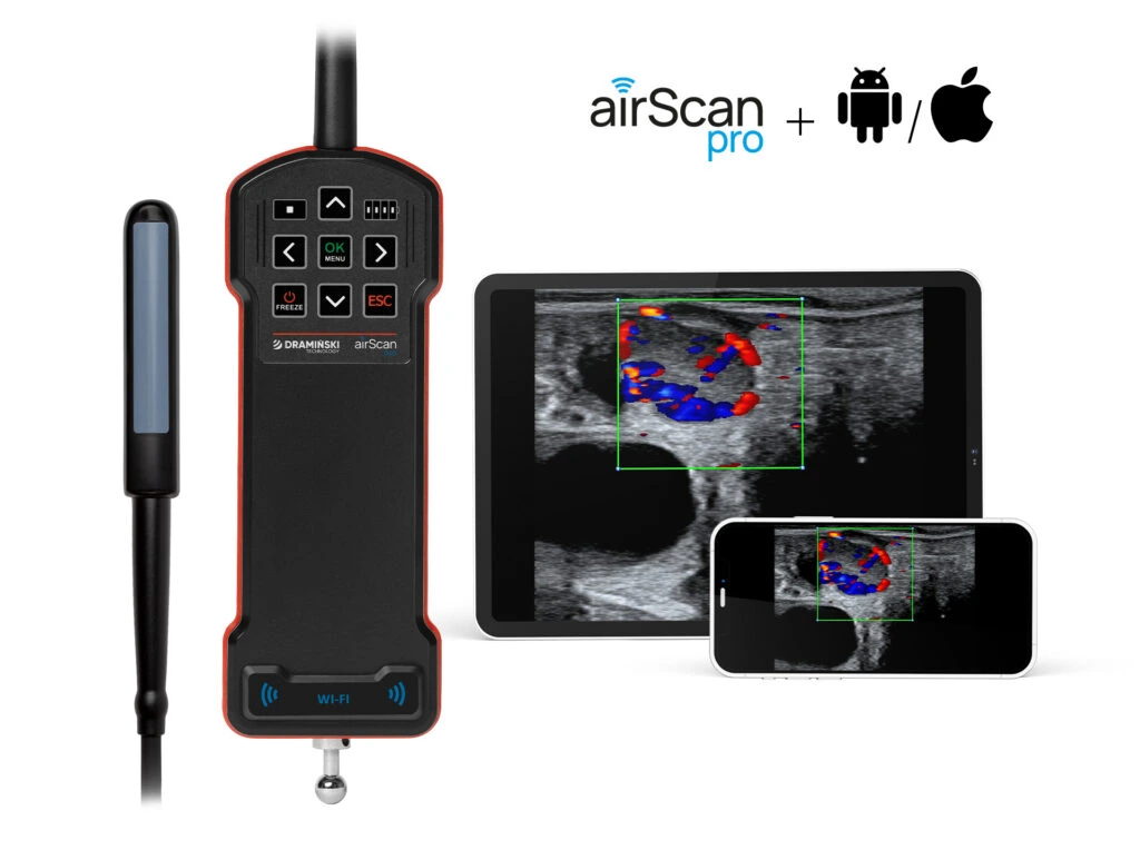 airScan-pro-bezprzewodowa-ultrasonografia-wymagania-sprzetowe-1024x764.webp